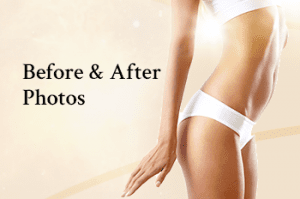 body | Westfield Plastic Surgery Center body