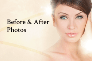 face | Westfield Plastic Surgery Center face