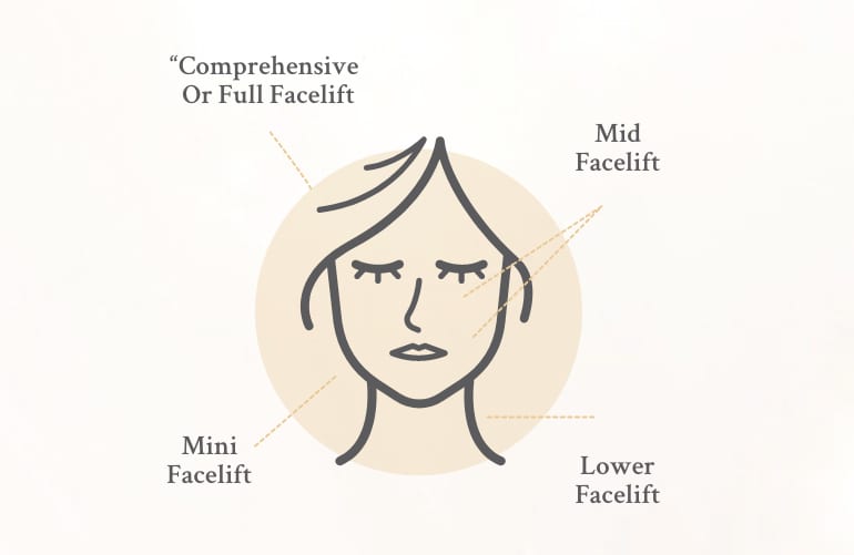 Facelift Surgical Techniques