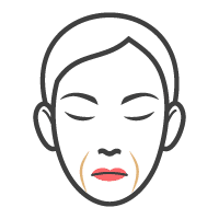 westfield icon nasolabial folds | Westfield Plastic Surgery Center Nasolabial folds icon